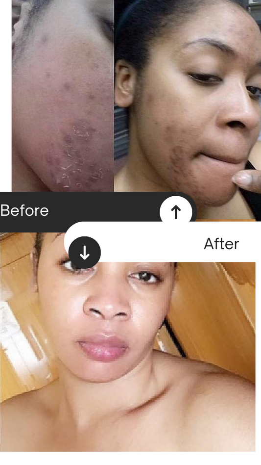 FACE CREAM/TUMERIC FACE WASH