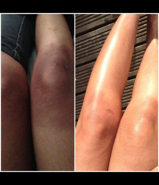 KNUCKLES BRIGHTENING SET